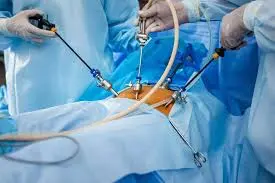 What is Bariatric Surgery? Types, Benefits, Risks & Recovery Explained