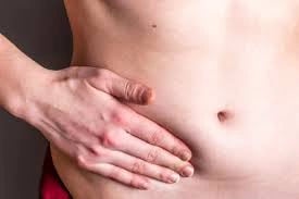 What Are the Signs You Need Hernia Surgery?
