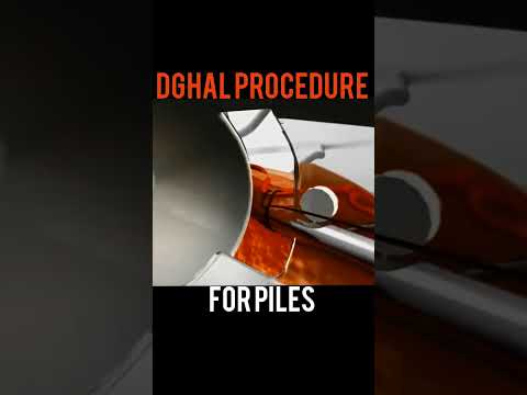 Laser Hemorrhoidoplasty Walkthrough