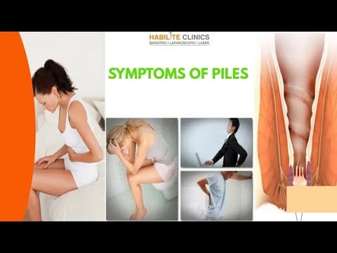 Piles & Anal Disorders: Causes, Grades, Treatment Roadmap