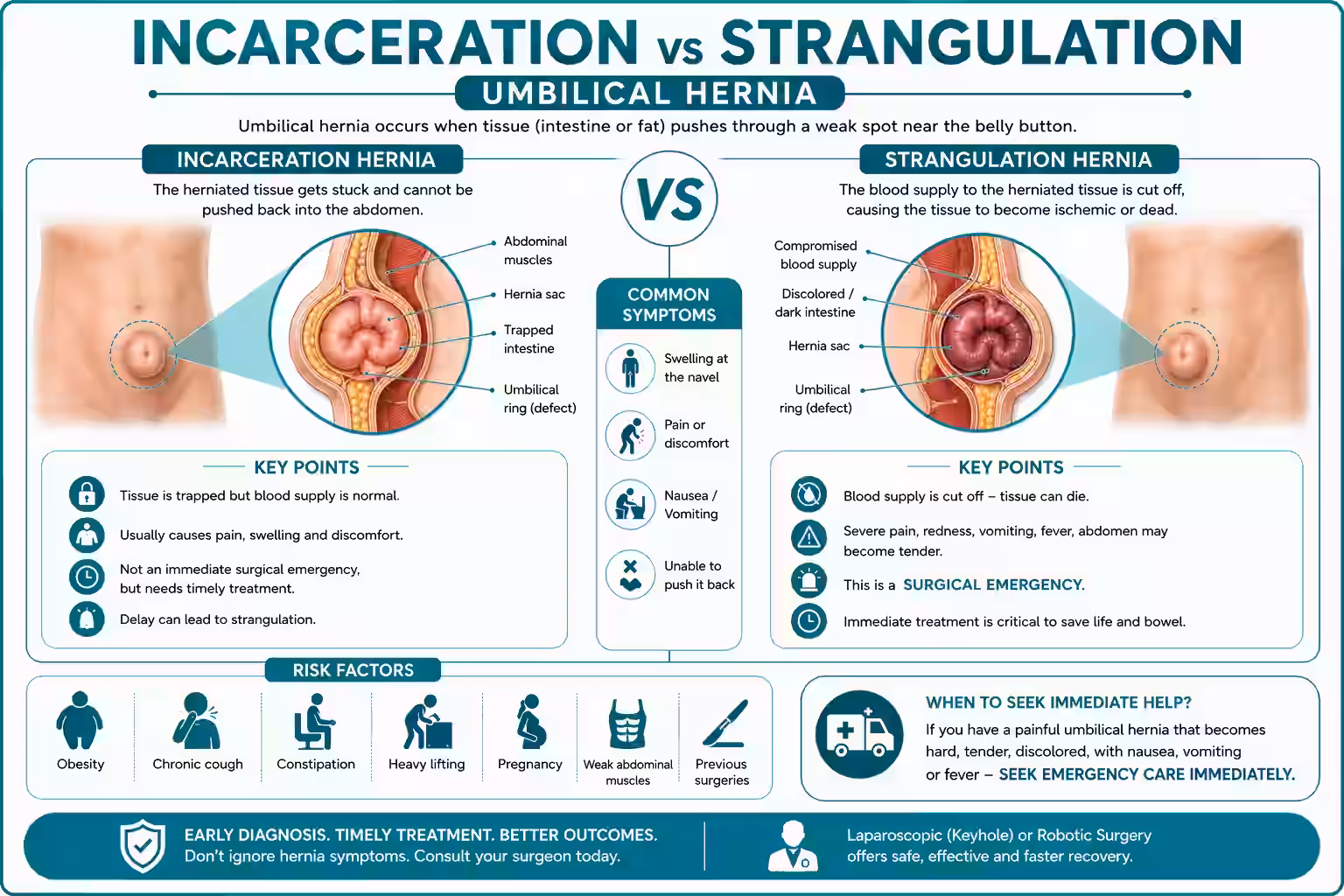 Incarceration vs Strangulation Hernia