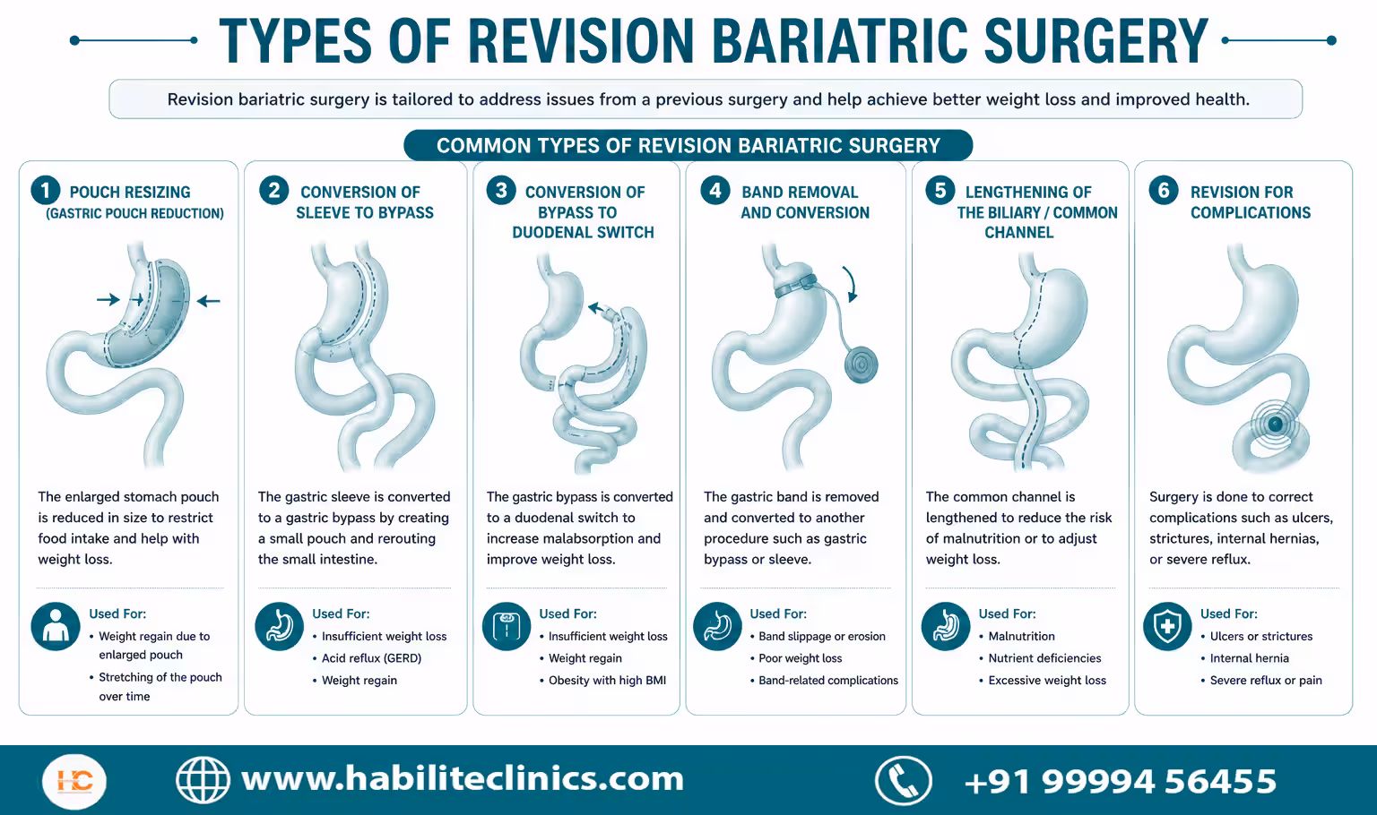 Types of Revision Bariatric Surgery