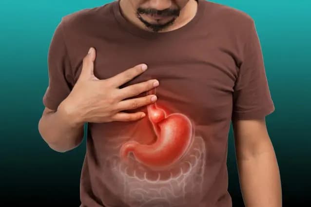 GERD & Hiatus Hernia Surgery in Delhi - Expert laparoscopic surgery in Delhi, India by Dr. Kapil Agrawal