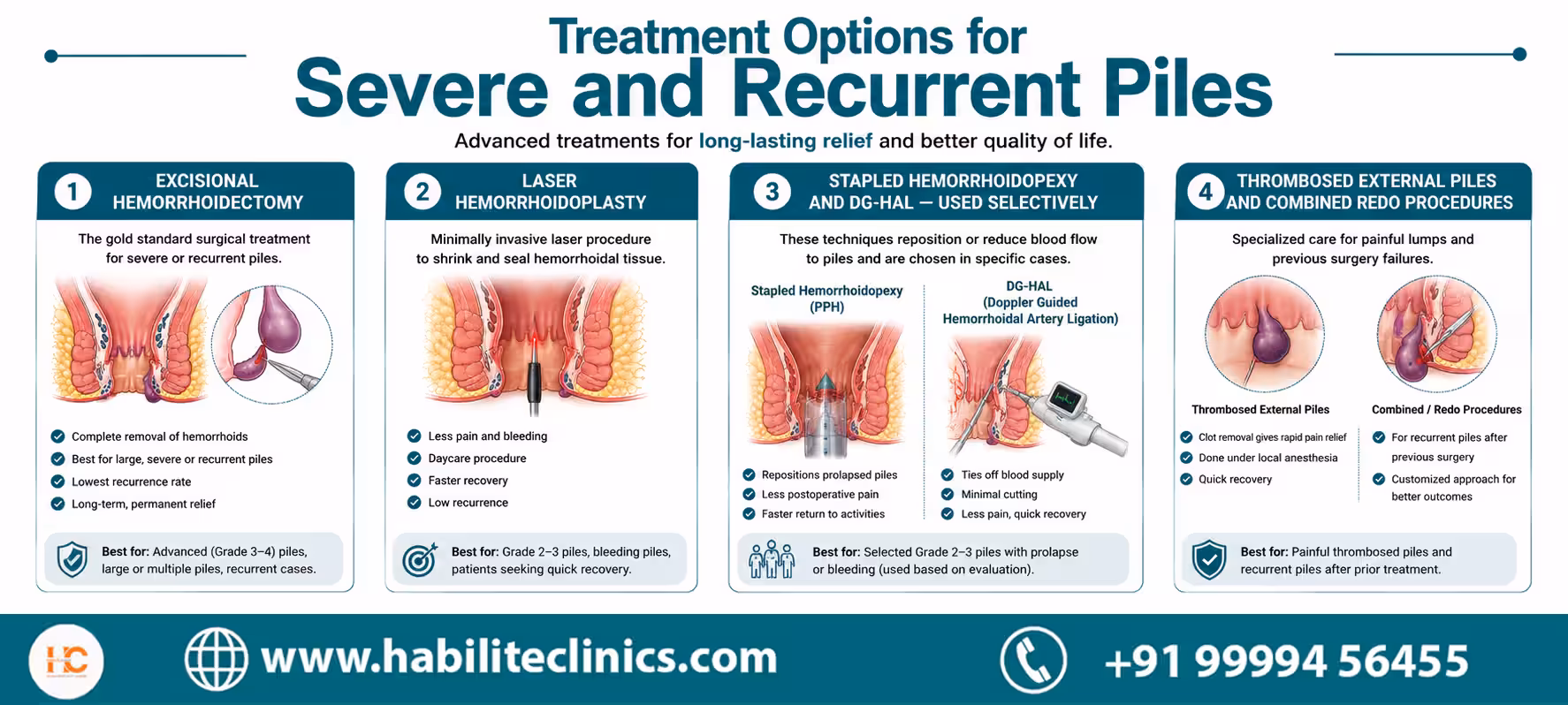 Treatment Options for Severe and Recurrent Piles