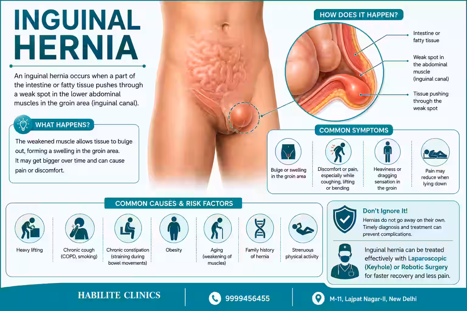 What exactly is an inguinal hernia