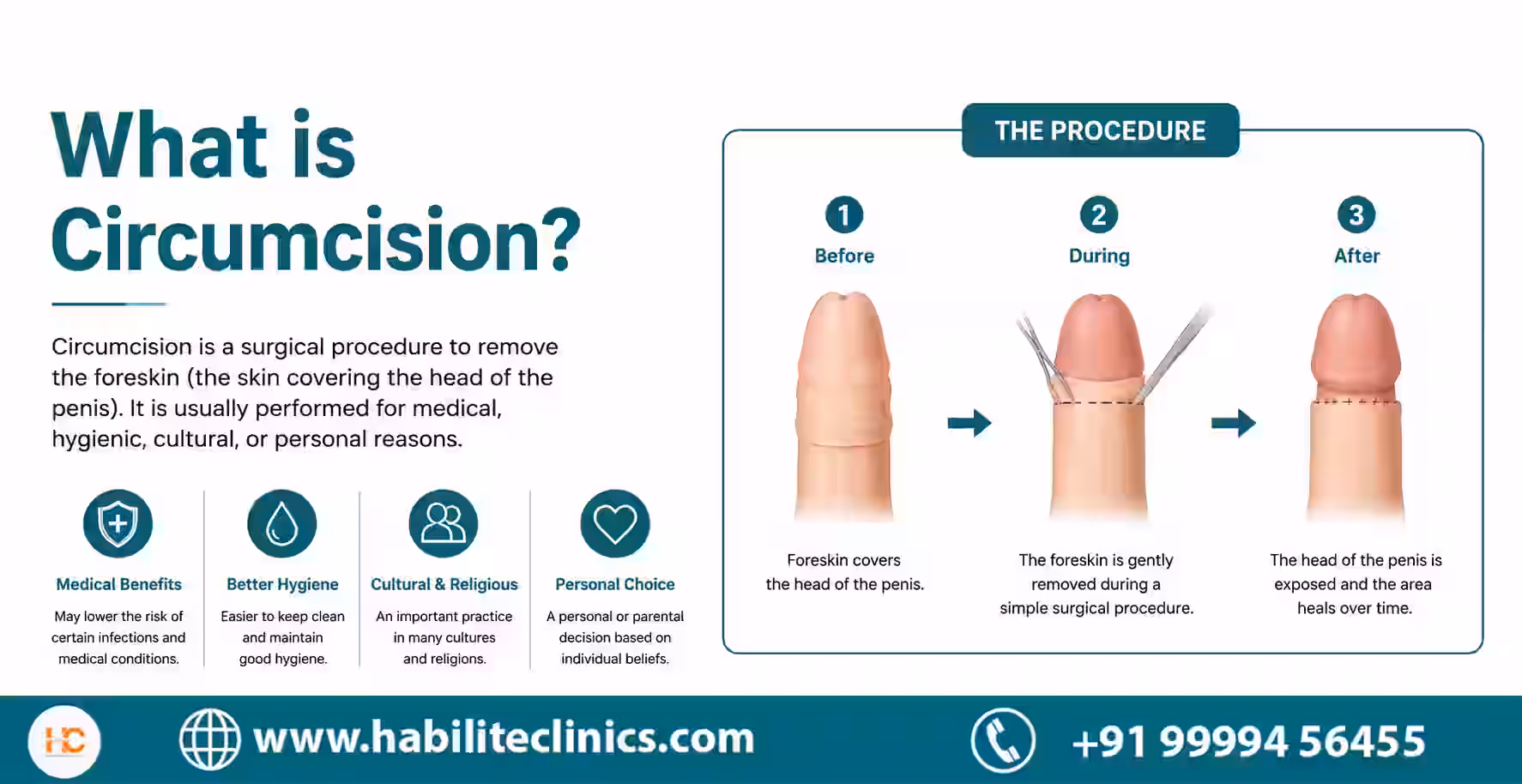 what is circumcision
