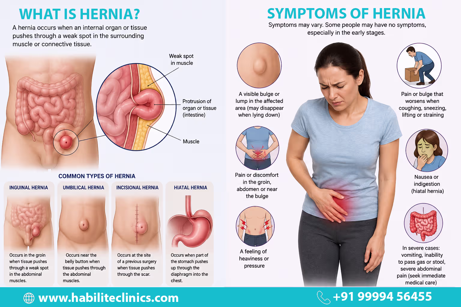 What is hernia and its common symptoms