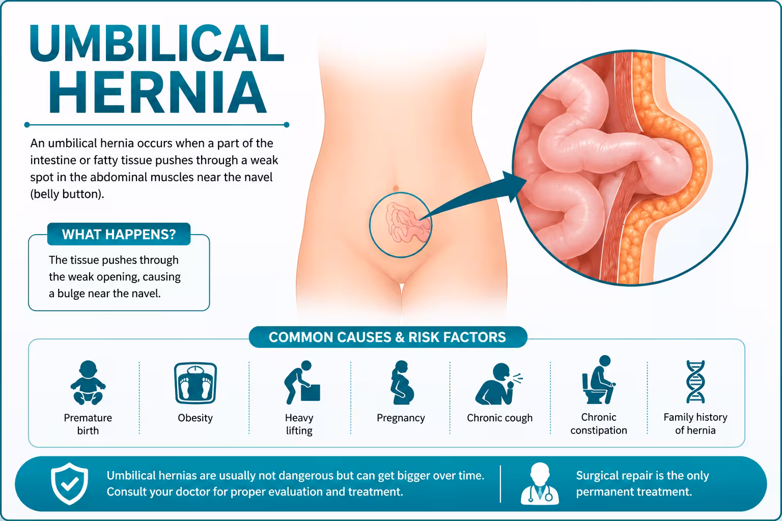What Is an Umbilical Hernia