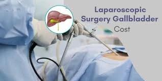 10 Questions to Ask Your Surgeon Before Gallbladder Surgery