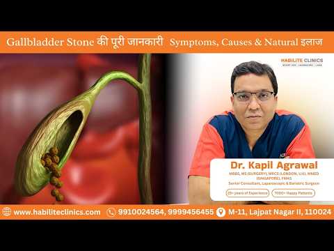 Gallbladder Stones: Causes, Symptoms, Risk Factors & Treatment Options