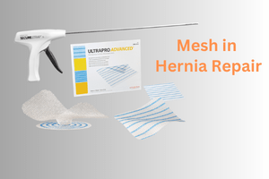 MESH IN HERNIA REPAIR: AN OVERVIEW