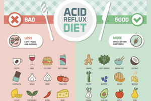 Gerd Diet for Acid Reflux