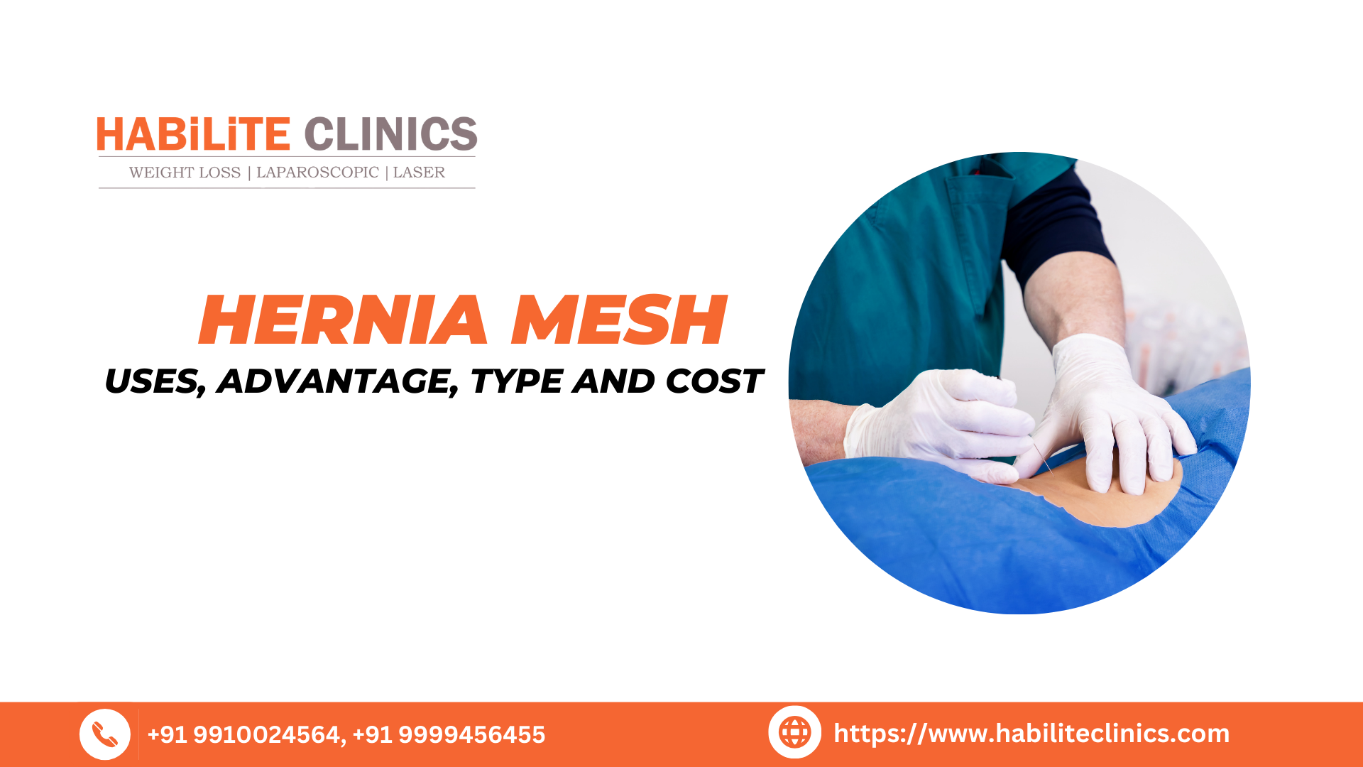 Hernia Mesh: Uses, Advantage, Type and Cost