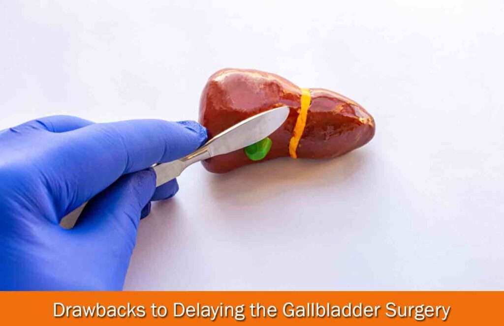 Drawbacks to Delaying the Gallbladder Surgery